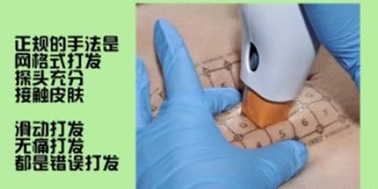 称热玛吉为"电波拉皮"，这是不是"夸大其词"?