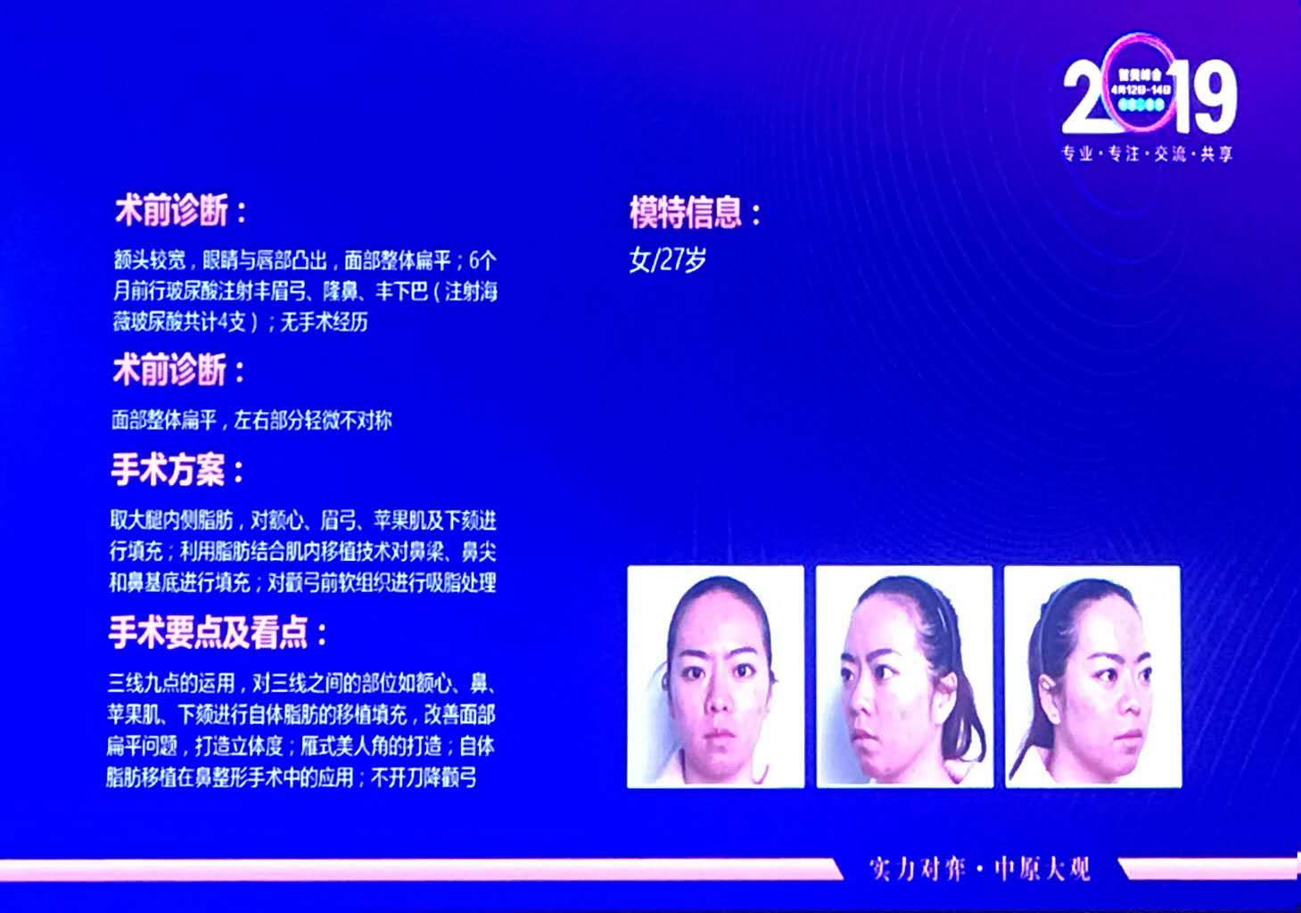 王东院长进行现场DCG同源脂肪驻颜术手术示教