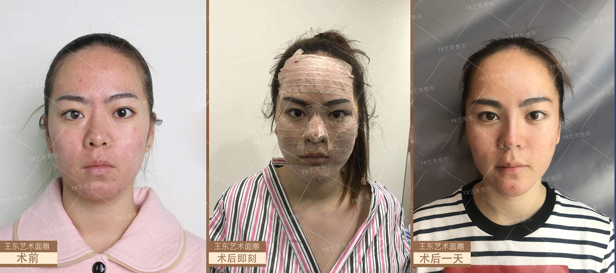 现场手术效果
