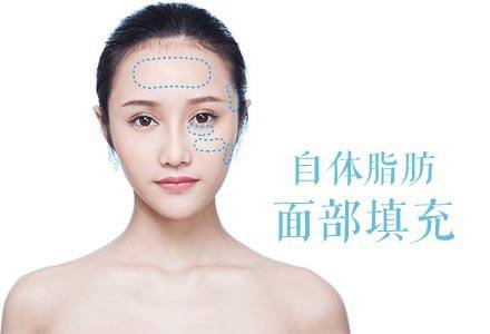自体脂肪丰苹果肌