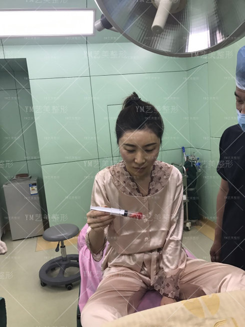 一针降颧骨颧弓求美者术后恢复