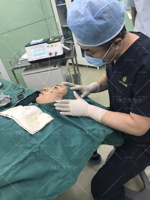 一针降颧骨颧弓术前准备