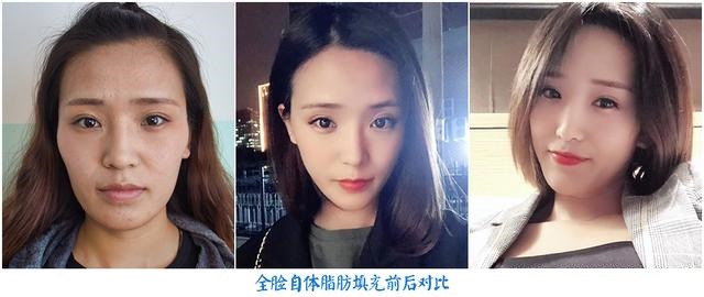 有人说，皮肤松弛和吃甜食有关，是不是在"夸大其词"？