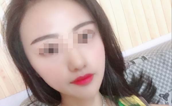 哪些因素会影响下颌角整形安心性?
