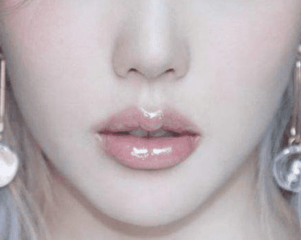 艺美王东解答：想要拥有Plump唇没什么比自体脂肪来的自然