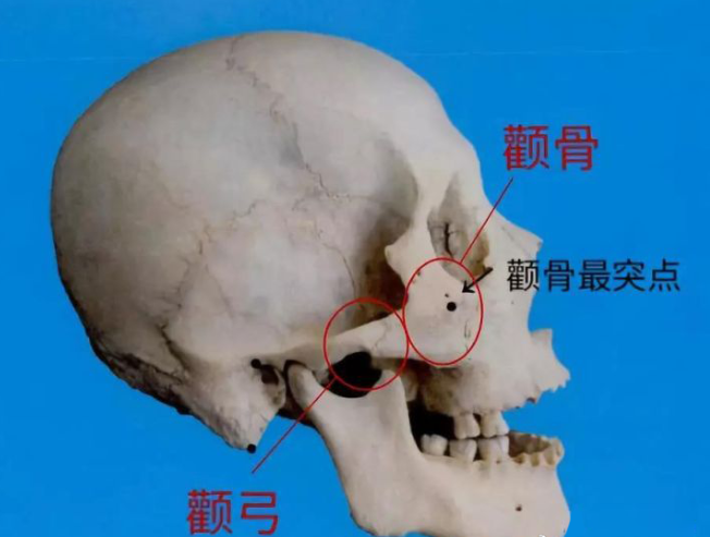 降颧骨