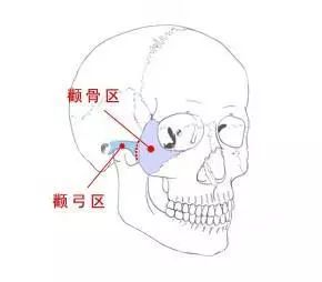 北京降颧骨,微创降颧骨,颧骨微整