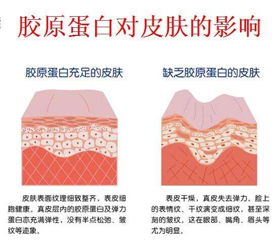 王东脂肪移植修复