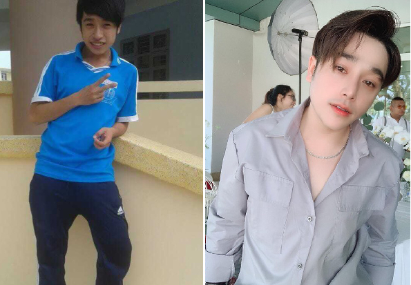 艺美面部整形,自体脂肪填充,北京艺美整形