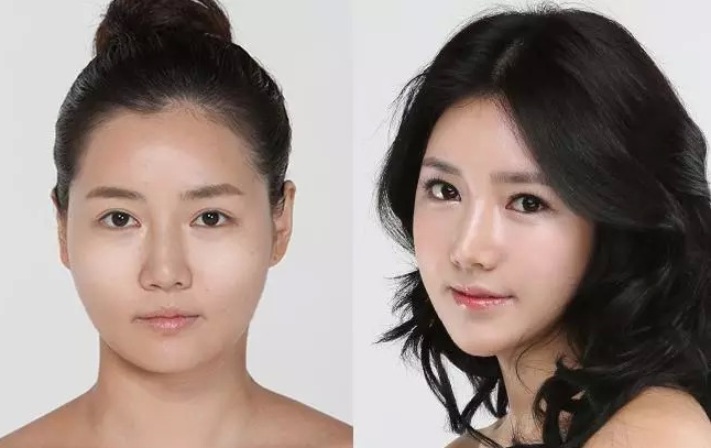 艺美巩敏面部精雕,巩敏面部填充,艺美整形巩敏