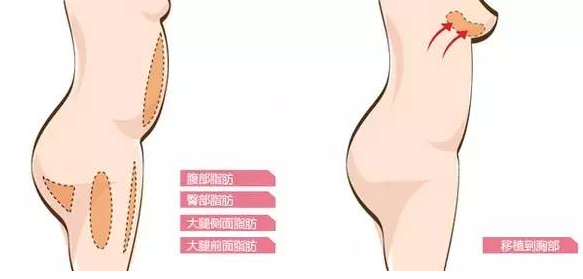 艺美巩敏面部精雕,巩敏面部填充,艺美整形巩敏