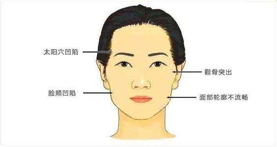 自体脂肪填充太阳穴后的感受 疼不疼