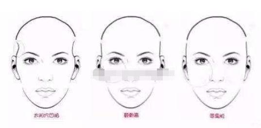 自体脂肪填充太阳穴多久可以洗脸？