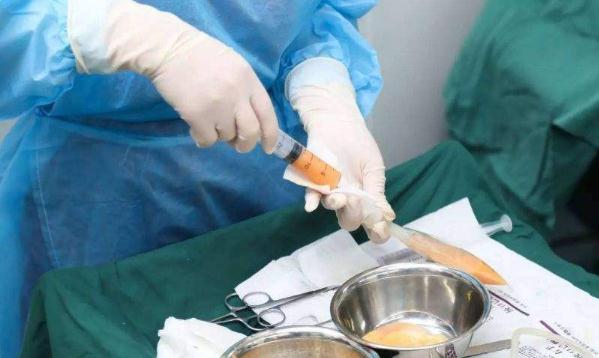 脸颊脂肪填充会全部吸收吗？怎样降低吸收率？
