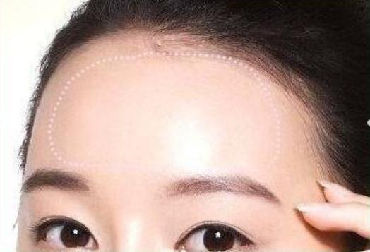 额头脂肪填充吸收快吗？效果能维持多久？