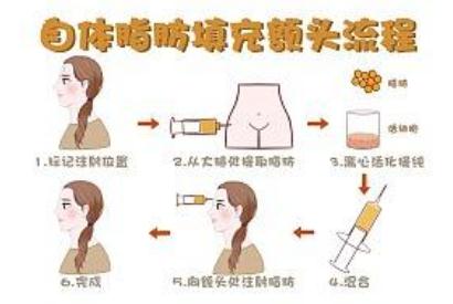 怎么填充额头自体脂肪：手术操作步骤