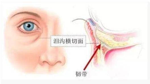 为何脂肪填充泪沟恢复慢？这几点你肯定没有做到！