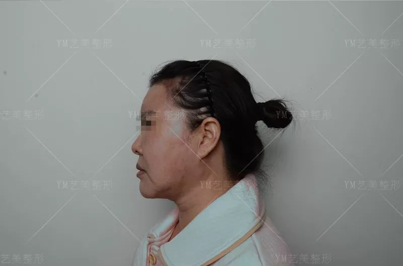 王东艺术面雕