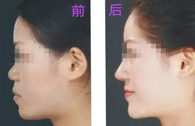 微信图片_20180323101852.jpg