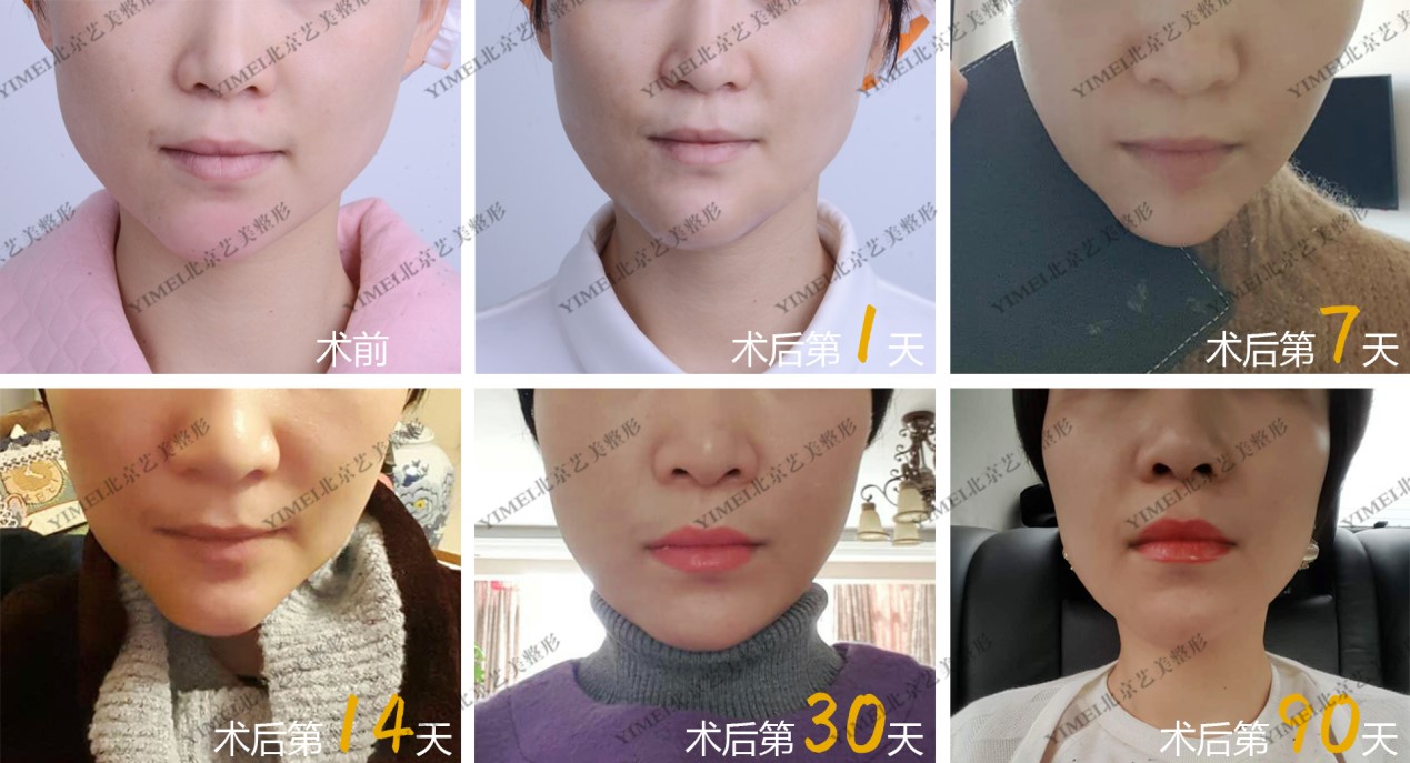 生长因子危害