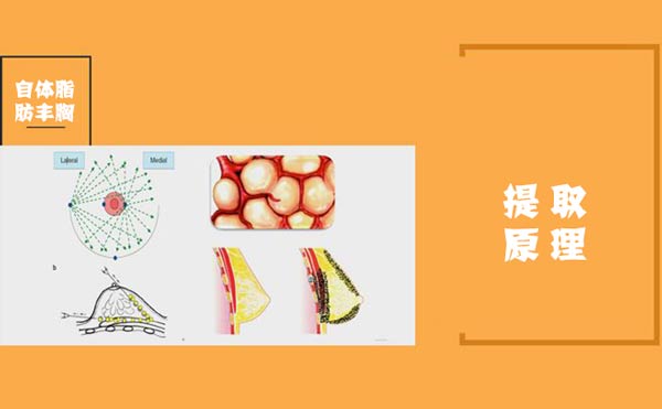 自体脂肪提取原理