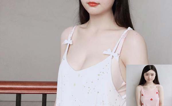 自体脂肪隆胸的病发症