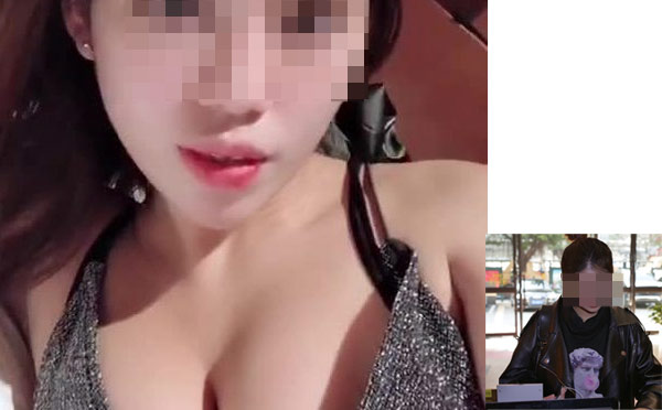 自体脂肪丰胸效果