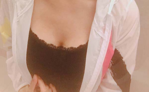 自体脂肪隆胸怎么样