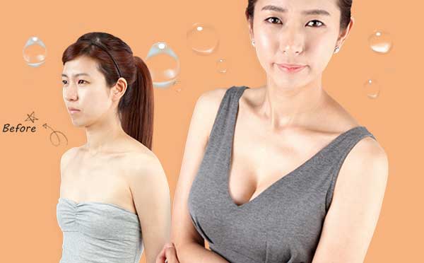 自体脂肪丰胸会有后遗症吗?