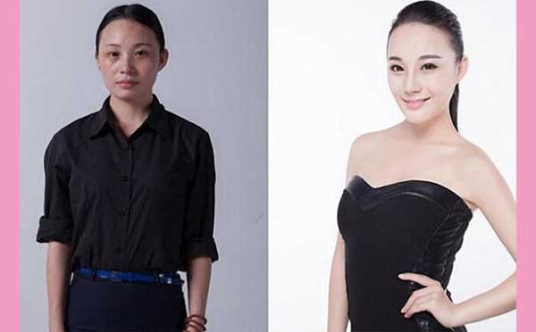  自体脂肪隆胸术后注意事项