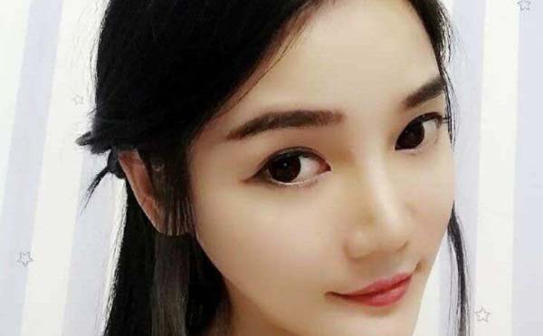 不适合做丰苹果肌手术的适应人群有哪些?