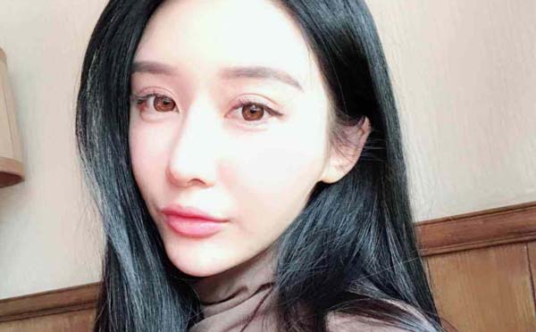 适合做丰苹果肌的人群