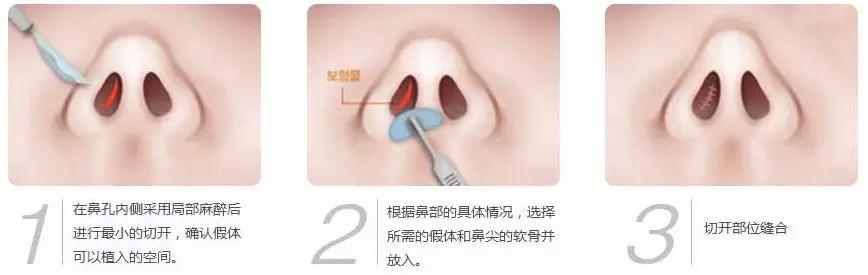 微信图片_20180319103158.jpg