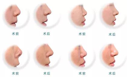 微信图片_20180420133920.jpg