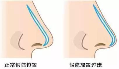 微信图片_20180319103154.jpg
